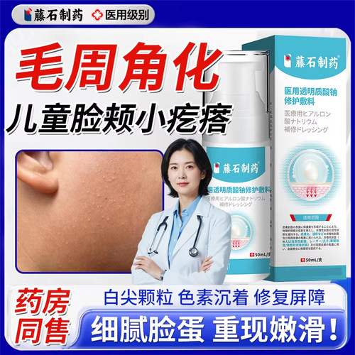 藤石制药儿童毛周角化症去除
