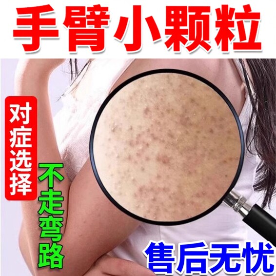手臂胳膊腿上鸡皮肤毛囊角化毛孔堵塞疏通有鸡皮小疙瘩去除神器VQ