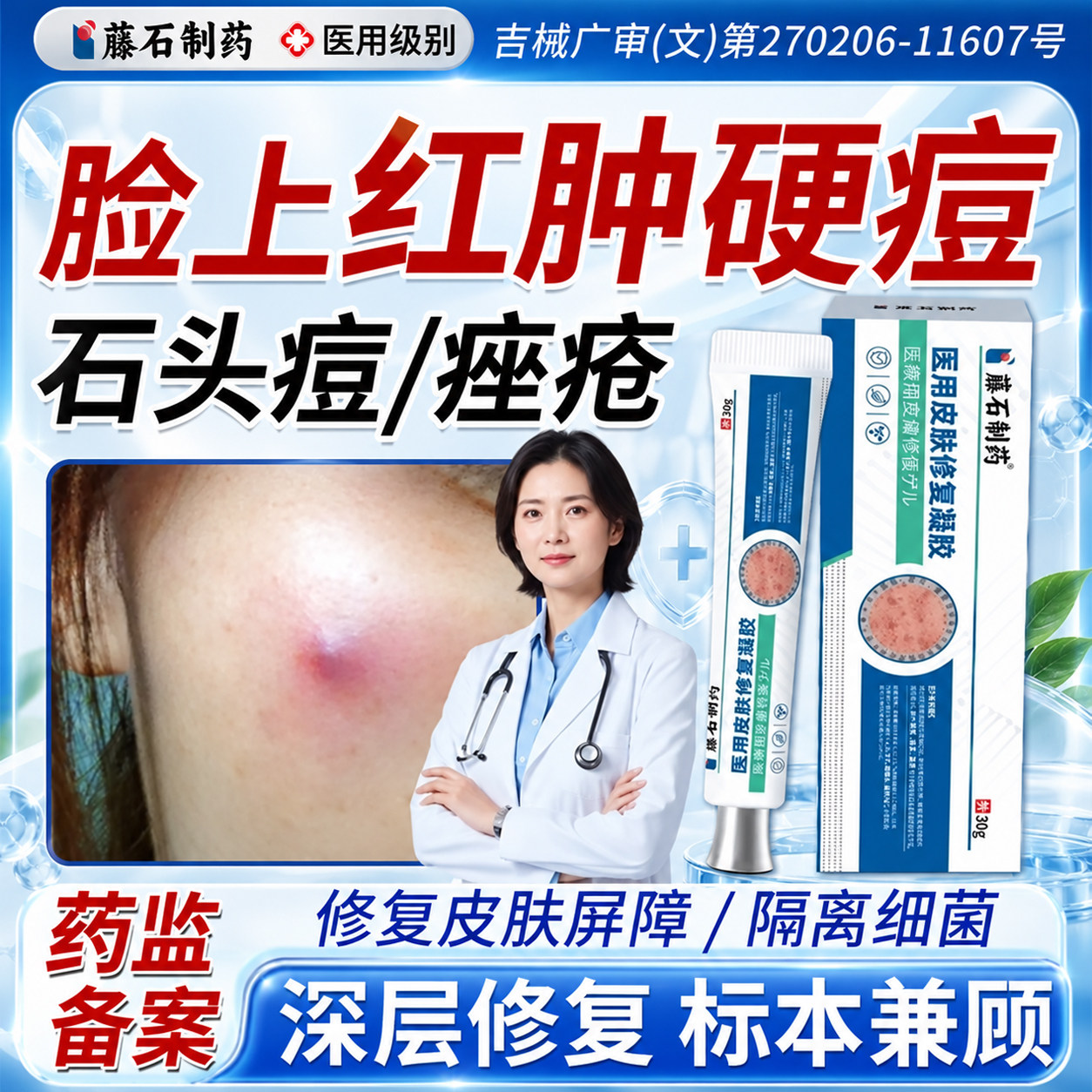 脸上红肿硬块痘型痘痘结节疙瘩痘上火祛痤疮药房同款WQ