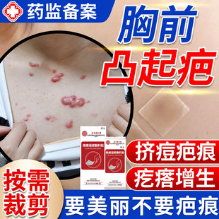 胸前疤痕疙瘩增生凸起祛疤贴去除瘢痕隐形遮盖止痒压力贴医用防WQ