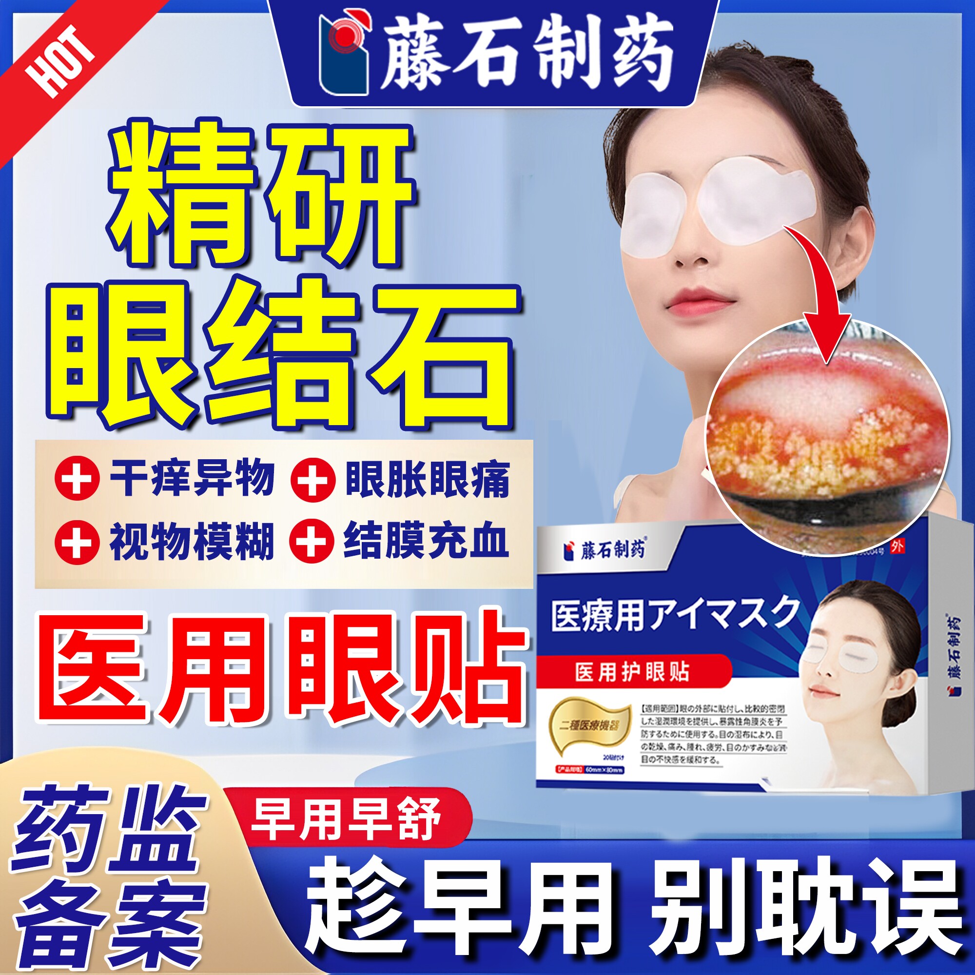 去眼结石眼贴眼睛有异物感可搭眼结膜结石针干涩发痒胀痛YZ