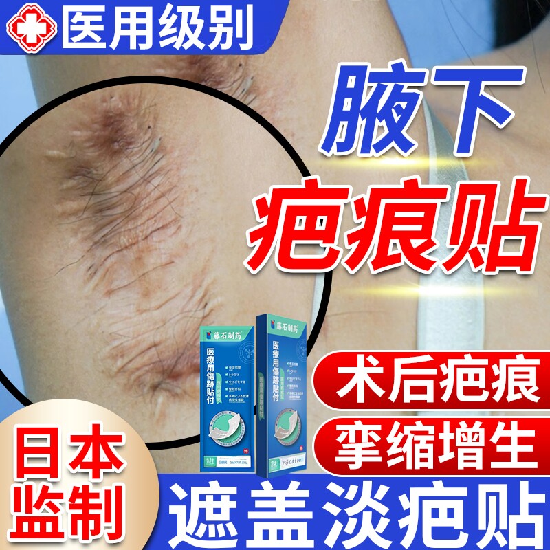腋下狐臭手术疤痕增生疙瘩修复隐形贴遮挡遮盖减张神器去除疤膏YZ