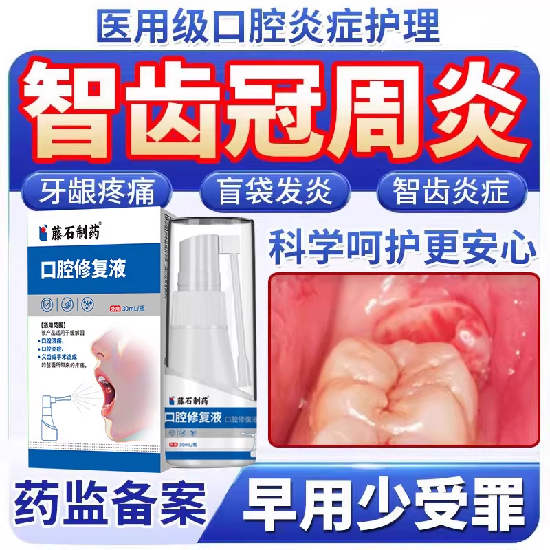智齿冠周炎牙龈肿痛脓包药房同售牙膏漱口水用牙疼牙痛喷雾喷剂TU