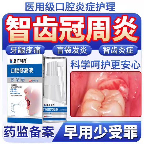 【口腔科同款】智齿冠周发炎疼痛