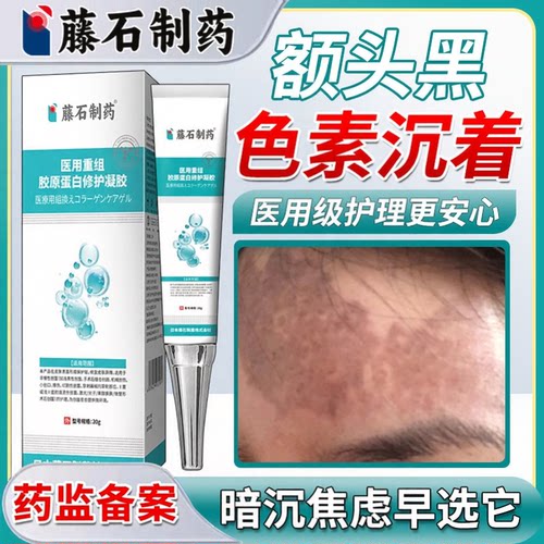 藤石制药额头黑黑色素沉淀去除
