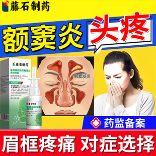上颌窦炎额窦炎头疼专用鼻窦炎鼻炎喷剂筛窦炎蝶窦炎药房同款HT