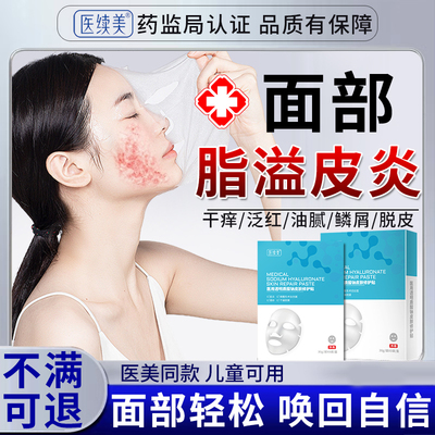藤石制面部药脂溢性皮炎