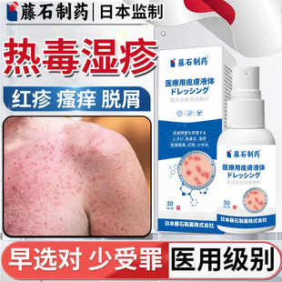 血热热毒湿疹水泡身上长红斑瘙痒喷雾剂止痒去膏根外用顽固皮炎DS