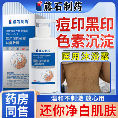 身上痘印黑印去黑色素沉淀沐浴露