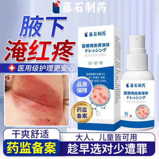 腋下淹红防腋窝胳肢窝成人痱子粉湿疹防淹脖子儿童出汗裂口疼痛VQ