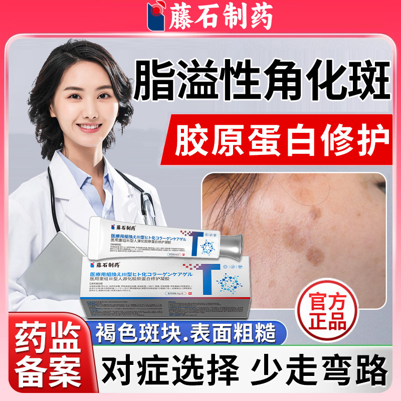 脂溢性角化斑老年斑强力去除手部手上祛除脸部一抹旗舰店正品净WQ