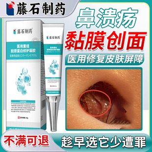 鼻中隔鼻腔溃疡上火鼻子生疮结痂鼻黏膜糜烂干燥性鼻炎修凝胶复HT