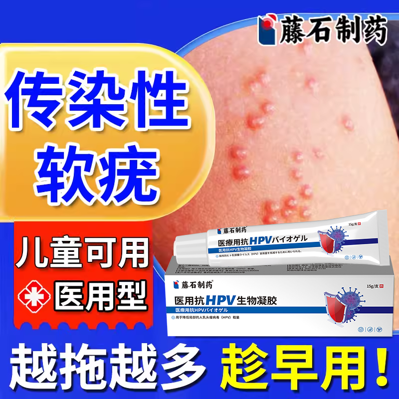 传染性软疣儿童去水猴子夹子祛除搭医用治疗镊子夹用药房同款膏TU