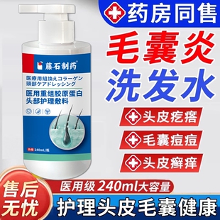 头皮毛囊炎洗发水头发头痒有疙瘩喷雾剂头癣专用脂溢性皮炎WQ