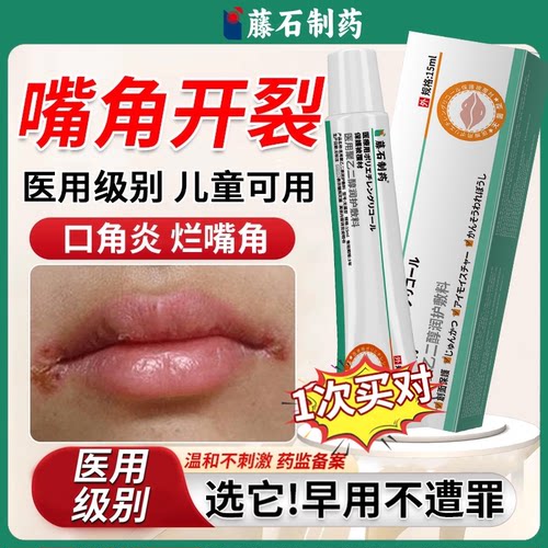 【日本监制】口角炎嘴角反复开裂