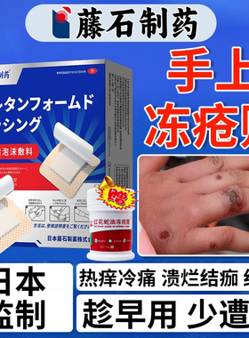 手上长冻疮手指冻伤冻疮贴冻疮膏止痒创口贴胶布医用手背膏药贴VQ