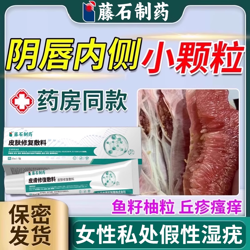 藤石制药女性假性湿疣阴唇颗粒