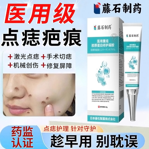 割痣点痣后疤痕护理医用级
