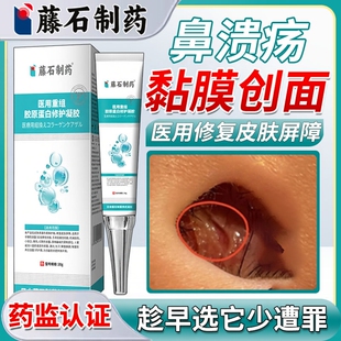 鼻中隔鼻腔溃疡上火鼻子生疮结痂鼻黏膜糜烂干燥性鼻炎修凝胶复HT