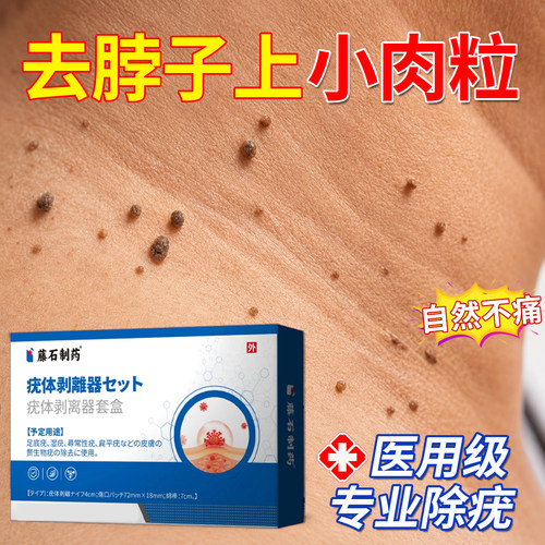 脖子丝状疣肉赘疣瘊肉粒去除神器