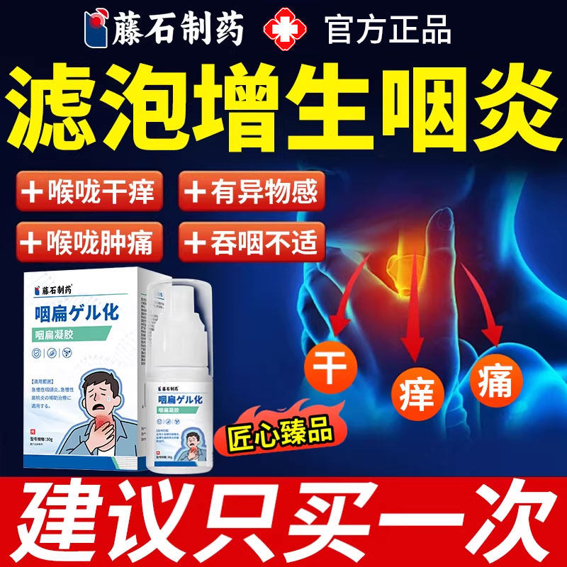 咽后壁淋巴滤泡增生慢性咽炎除儿童反流性咽喉炎贴根专用喷雾剂YZ