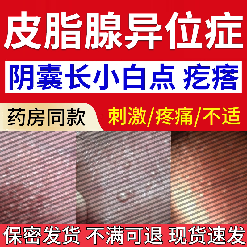 阴囊小疙瘩皮脂腺异位症潮湿瘙痒男人下面蛋皮痒私处龟头长白点wq