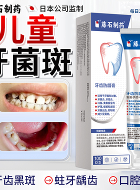 小孩儿童去祛除牙菌斑牙齿黑斑黑色素沉淀黄黑渍神器牙膏漱口水HT