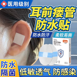 耳前瘘管防水贴耳朵手术伤口医用专用洗澡成人儿童清理工具耳贴VQ