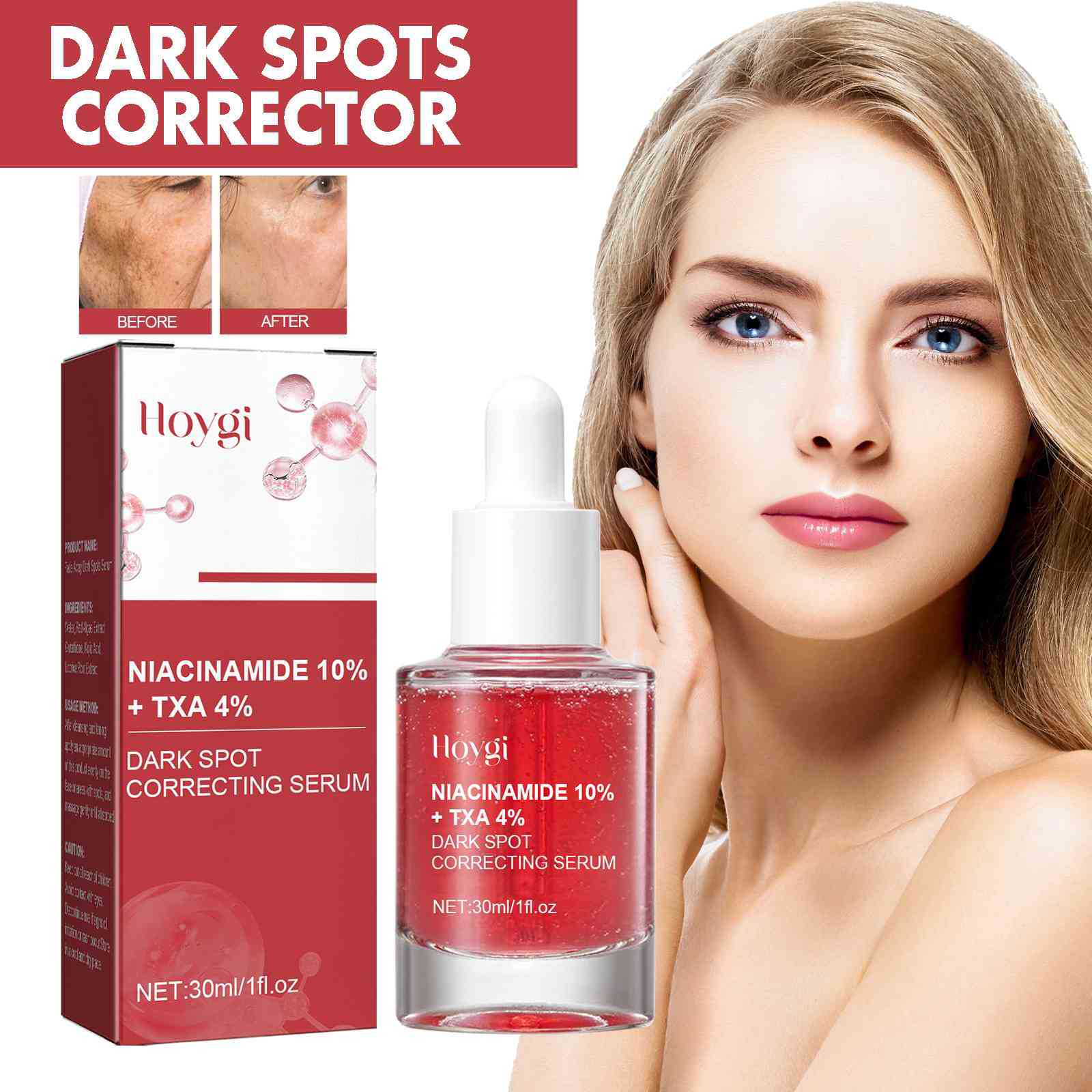 Hoygi Black Spot Repair Essence Lightens Skin Dark Spots 美容护肤/美体/精油 贴片面膜 原图主图