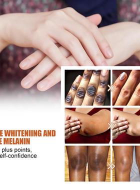 Pumpkinseed oil, lighten black flaps and elbows and lighten