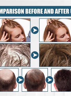 Sneaky hair spray, dry and dry hair-repaired hair-repair roo