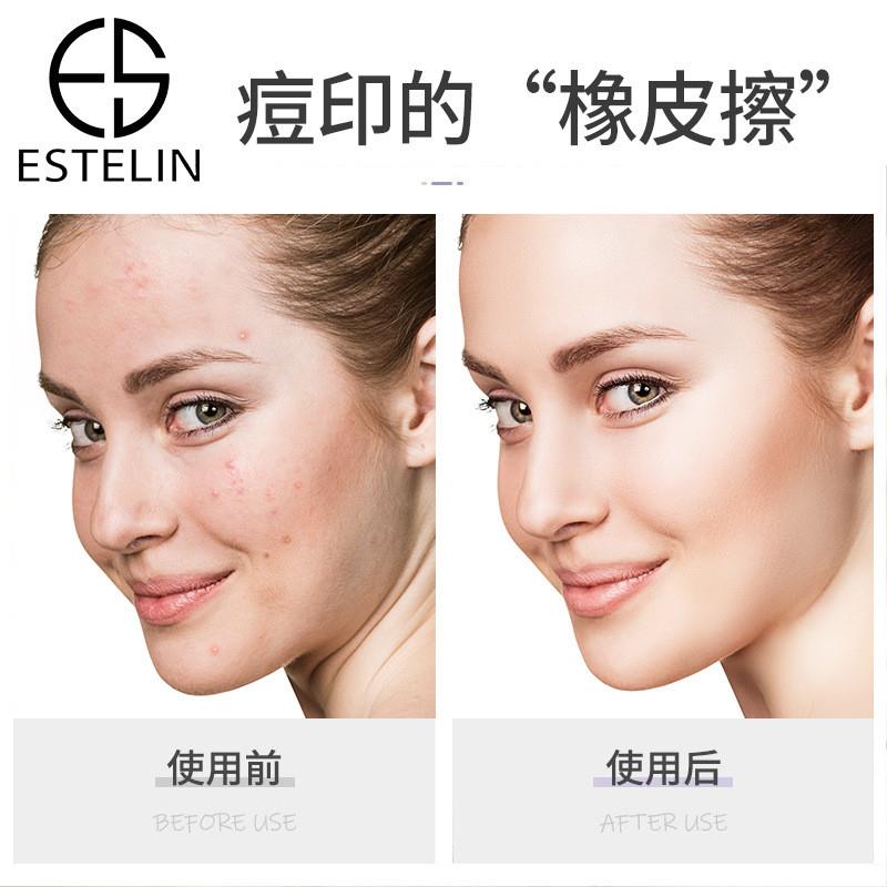 Lavender fixes sperm water to keep it wet and improves the s