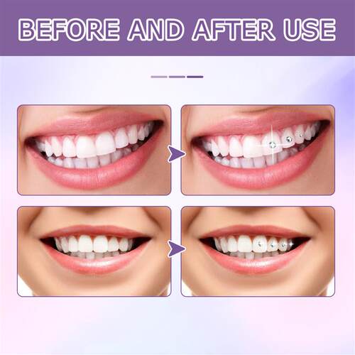 Toothstone decorated glue, tooth-dryed crystal-drilled stone