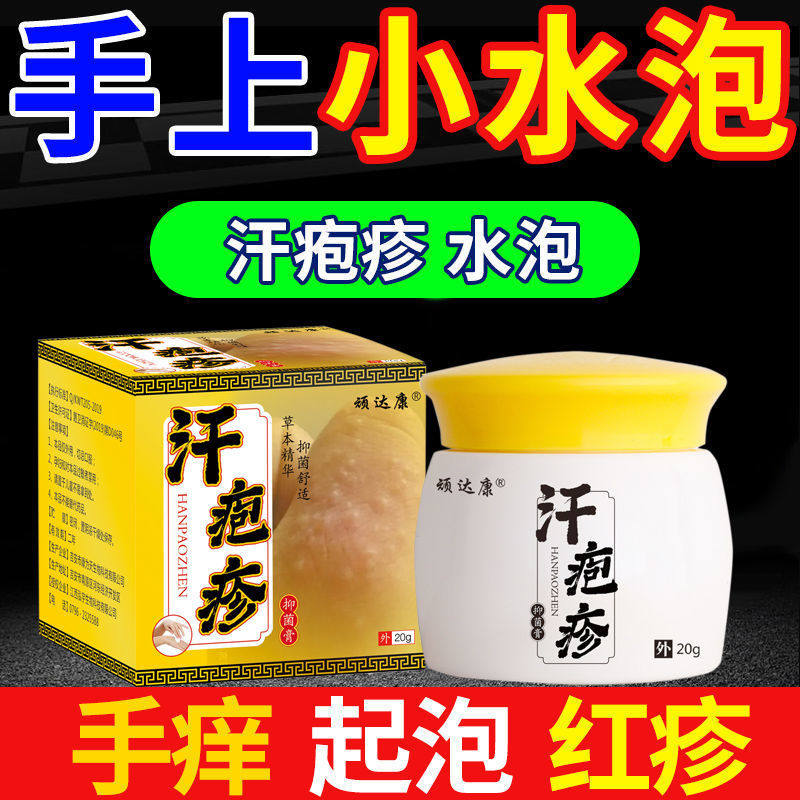 治汗疱疹鹅掌风手足廯季节性手痒脱皮真菌感染手上起小水泡止痒膏