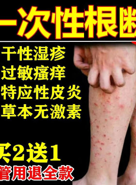治疗儿童特应性皮炎干性疹湿专用皮肤过敏全身瘙痒外用止痒膏根去