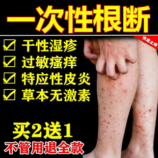 治疗儿童特应性皮炎干性疹湿专用皮肤过敏全身瘙痒外用止痒膏根去