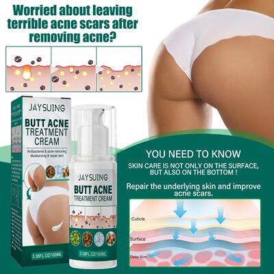 Jaysuing Buttock Care Cream - Moisturizing, Fades Acne Marks