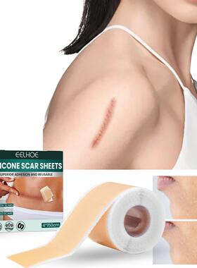 EELHOE Silicone Skin Repair Patch Gentle Care for Smooth Ski