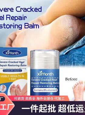 Ximonth Heel Repair Cream prevents and repairs dry, cracked