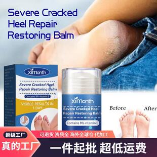 Ximonth Heel Repair Cream prevents and repairs dry, cracked