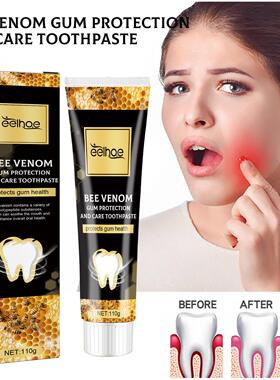 EELHOE Bee Venom Gum Protection Toothpaste - Deep Cleaning f