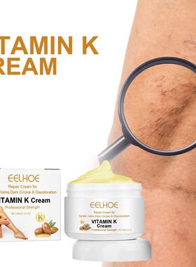EELHOE Vitamin K Cream Skin Care Leg Massage Cream