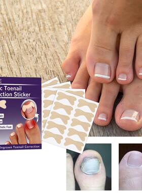 EELHOE Elastic Toenail Correction Stickers, Nail Care Ingrow