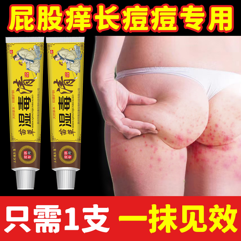 大人屁股上长痘痘痒起火疖子热疙瘩藓久坐拔毒膏红瘙痒坐板疮皮肤
