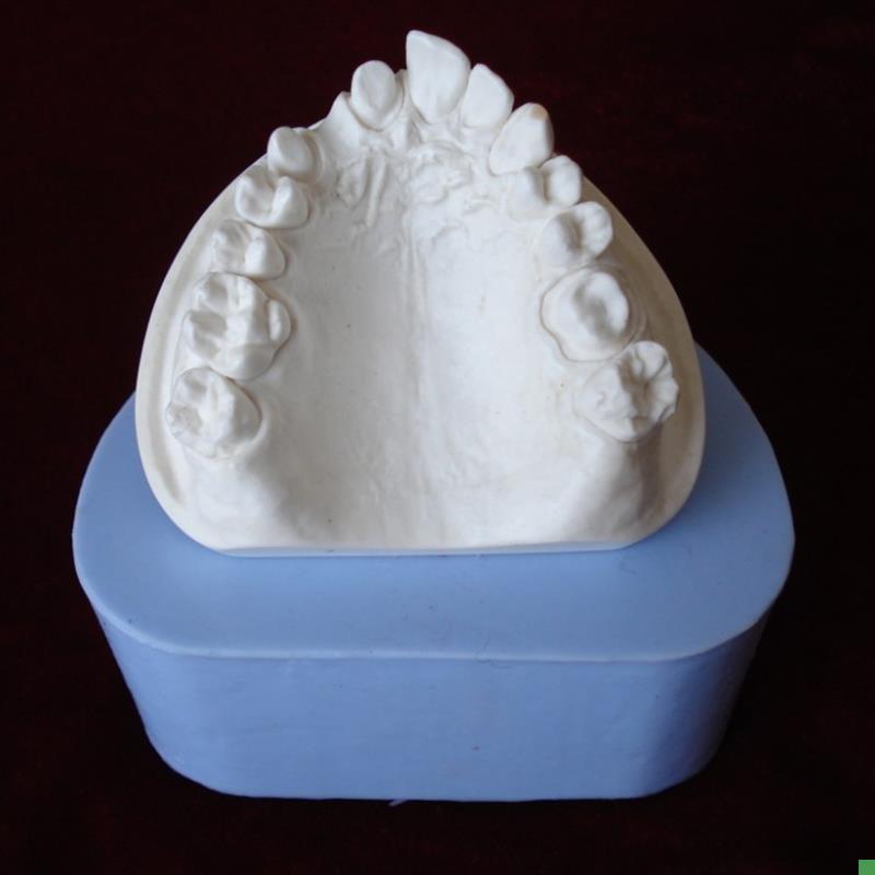 ENOVO颐诺口腔齿科技工展示模型硅橡胶阴M模模型备牙假牙义齿加工