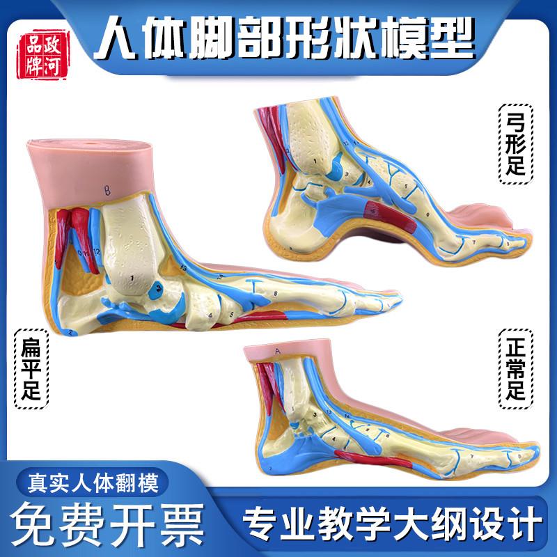 政河脚形状弓形扁平正常形态人体教学模型足疗会所医X院手脚科摆