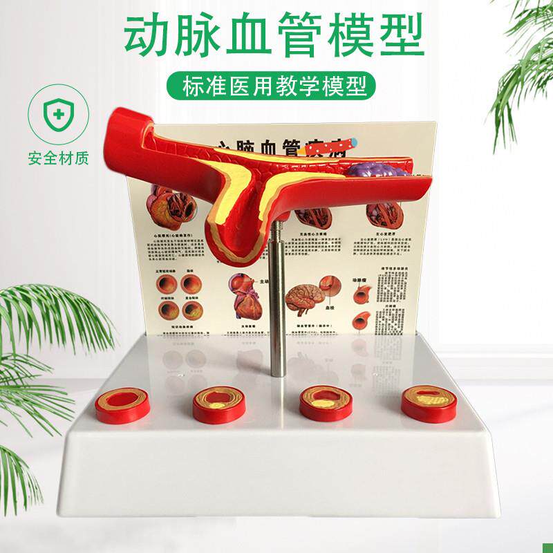 人体支脉粥样11硬化心血管动脉1解剖模型血栓S模型人体血管模型