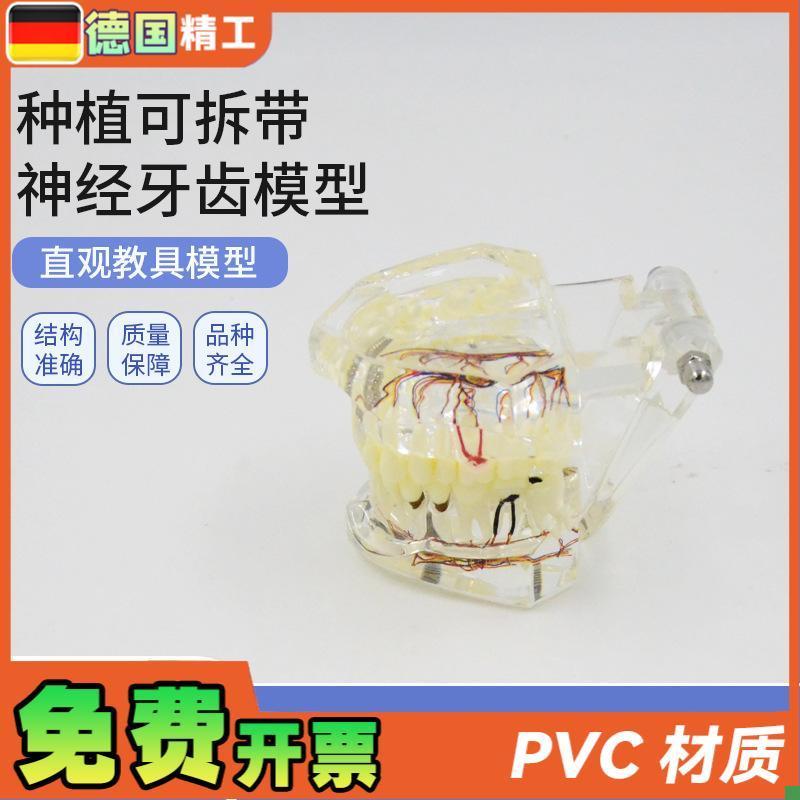 德国】PNT-OR16口腔牙科种植可拆带神经牙齿模型U可拆卸口腔修复