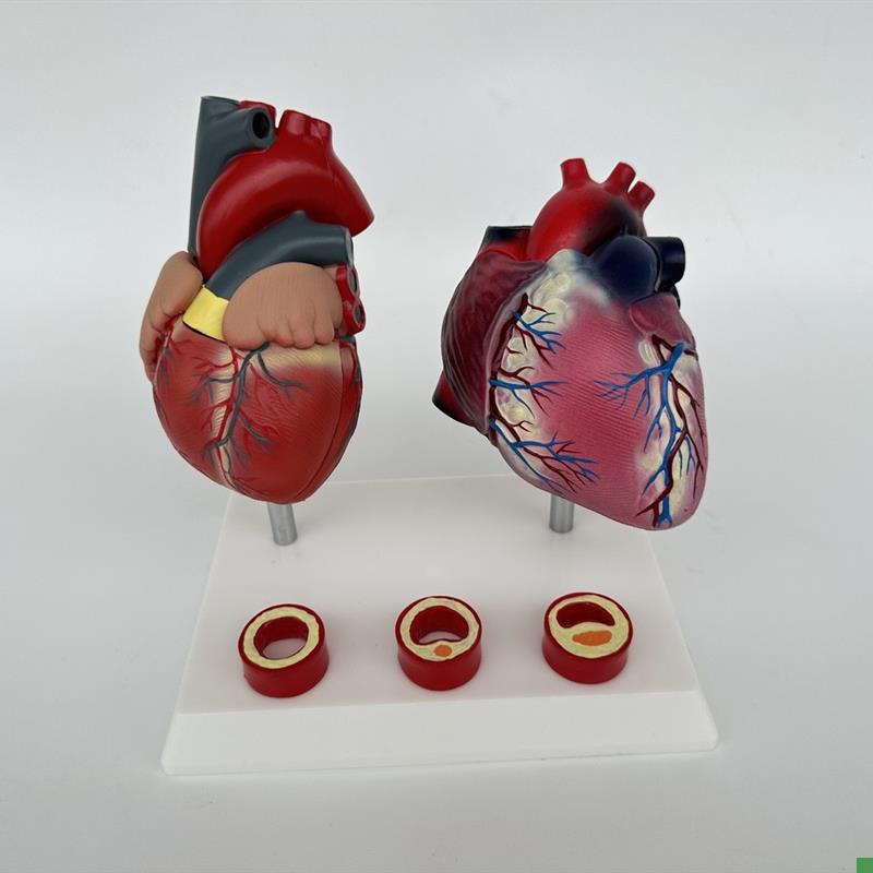 人体血管压高病理解剖q心脏与内脏健康心脏血管构造对比教学模具