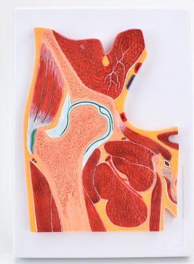ENOVO颐诺医学解剖髋关节骨骼肌肉模型I髋关节剖面构造MRI骨科关